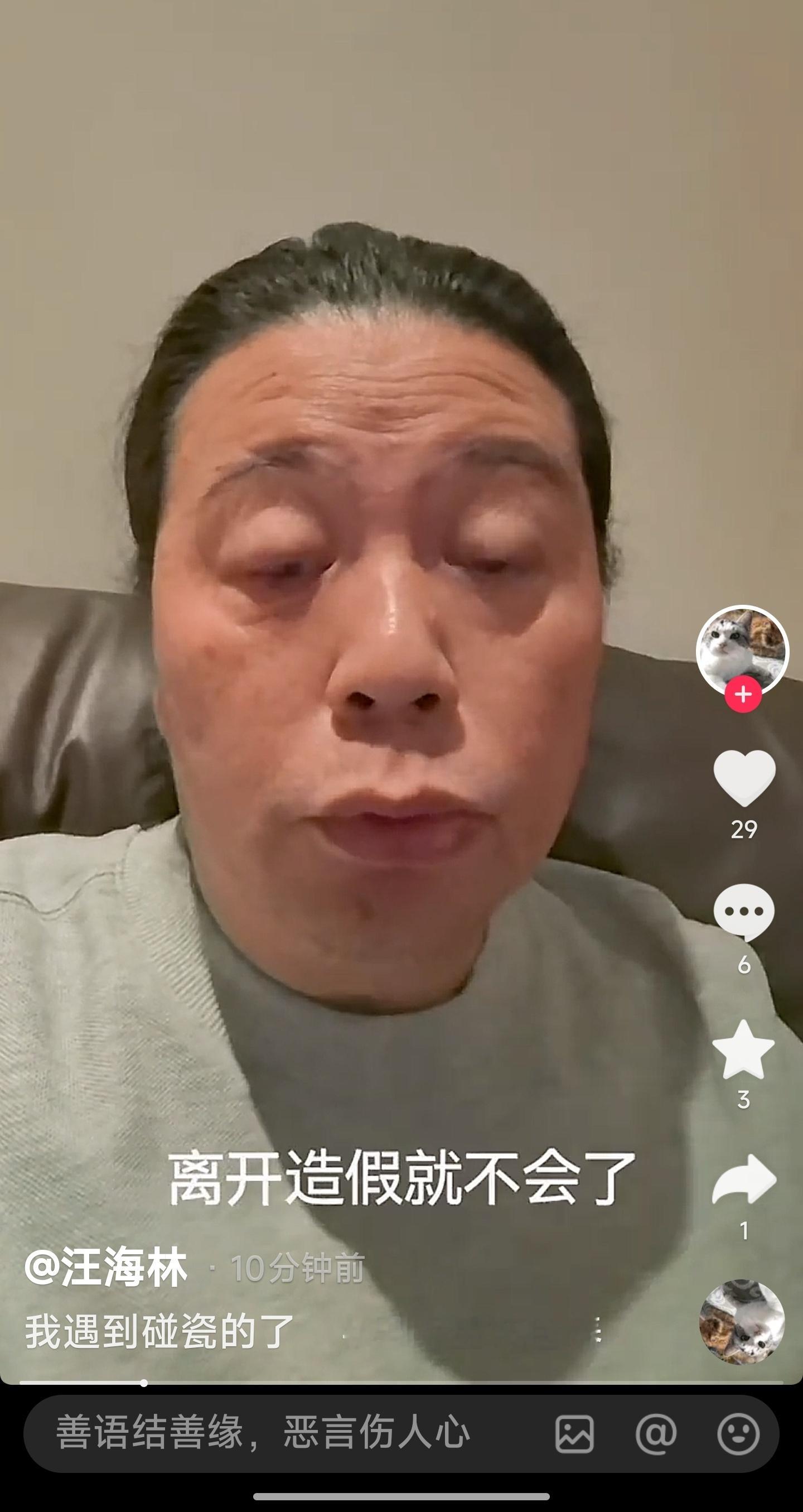 汪海林可能生大病了，甲状腺那些……​​​