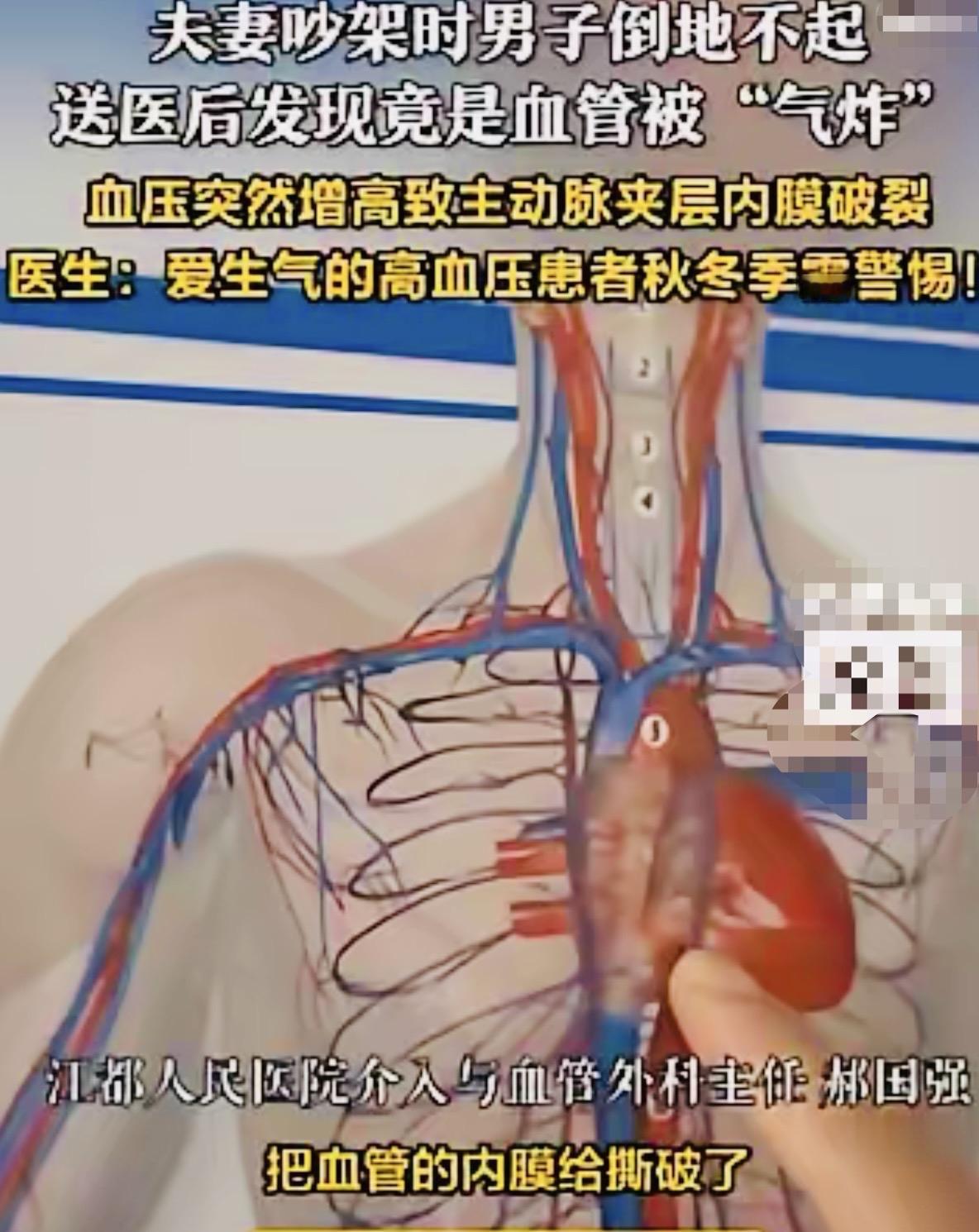 气大伤身江苏一位张姓男子，因家庭琐事，与妻子发生激烈争吵，将血管气到爆炸。