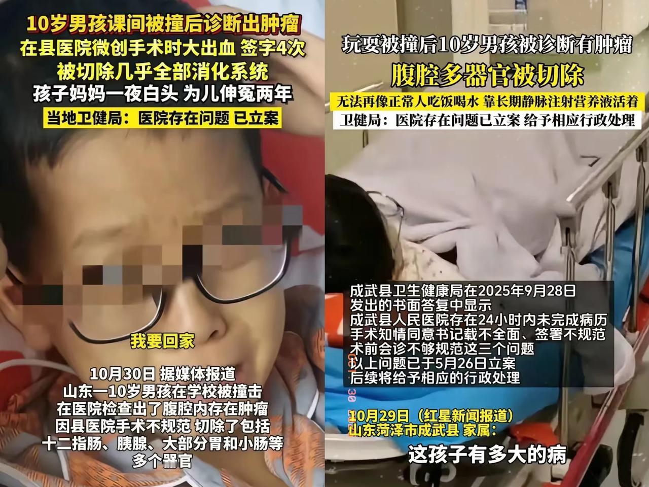 太离谱了!成武县12岁男孩,两年前摔了一跤,县医院说有腹腔肿瘤,家长稀里糊