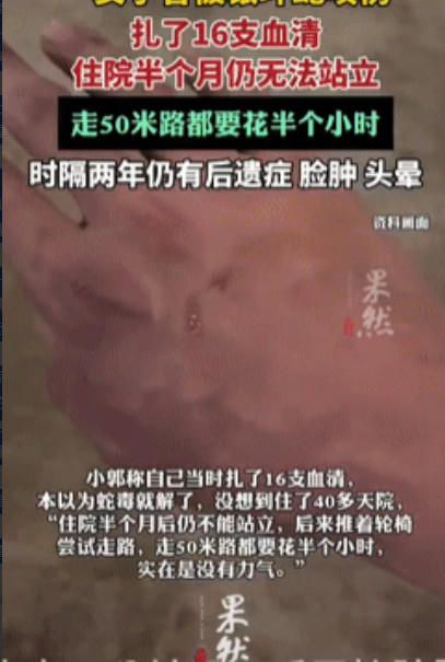 “命真大！”6月6日，一女子和丈夫去云南普洱旅游时，在酒店的床上不幸被银环蛇咬伤