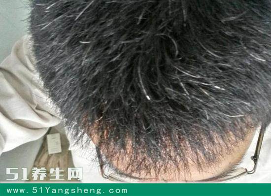 头上长白发, 很多情况下是因为缺了它, 别再乱投医了!