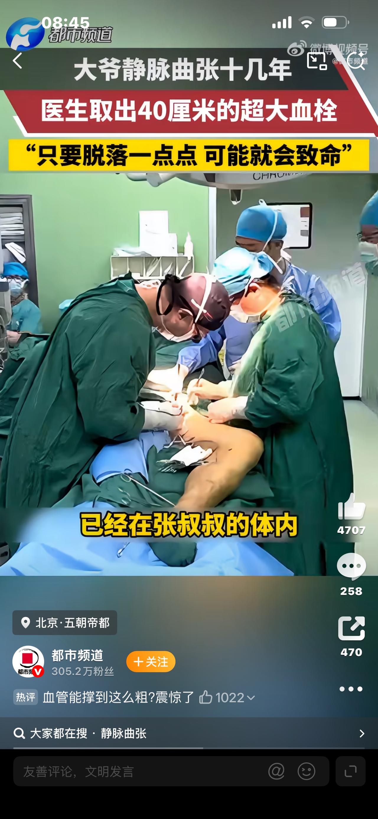 标题：大爷静脉曲张十几年，体内竟取出40厘米长血栓，看完很多人都后怕！不敢