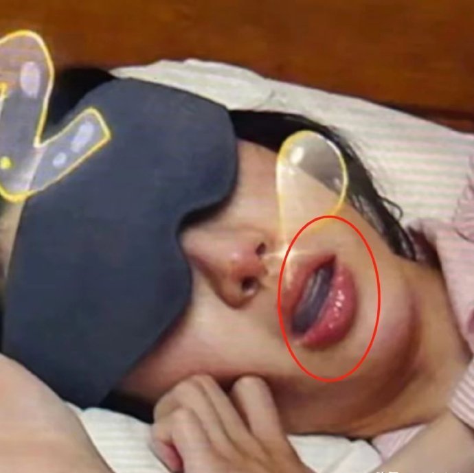 太狠了！金晨在《花少》中睡觉时，鼻孔和嘴巴都要时刻带着保持器​​​