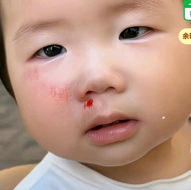 妈妈带娃让宝宝摔了不敢回家，这怎么解释不会挨批啊，网友出主意说，你要比她摔得更