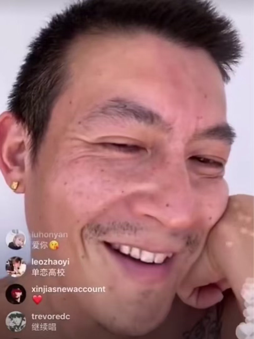 吓到我了！陈冠希四十多岁的脸上好像都开始长老人斑了，我说人能不能体面的老去，这照