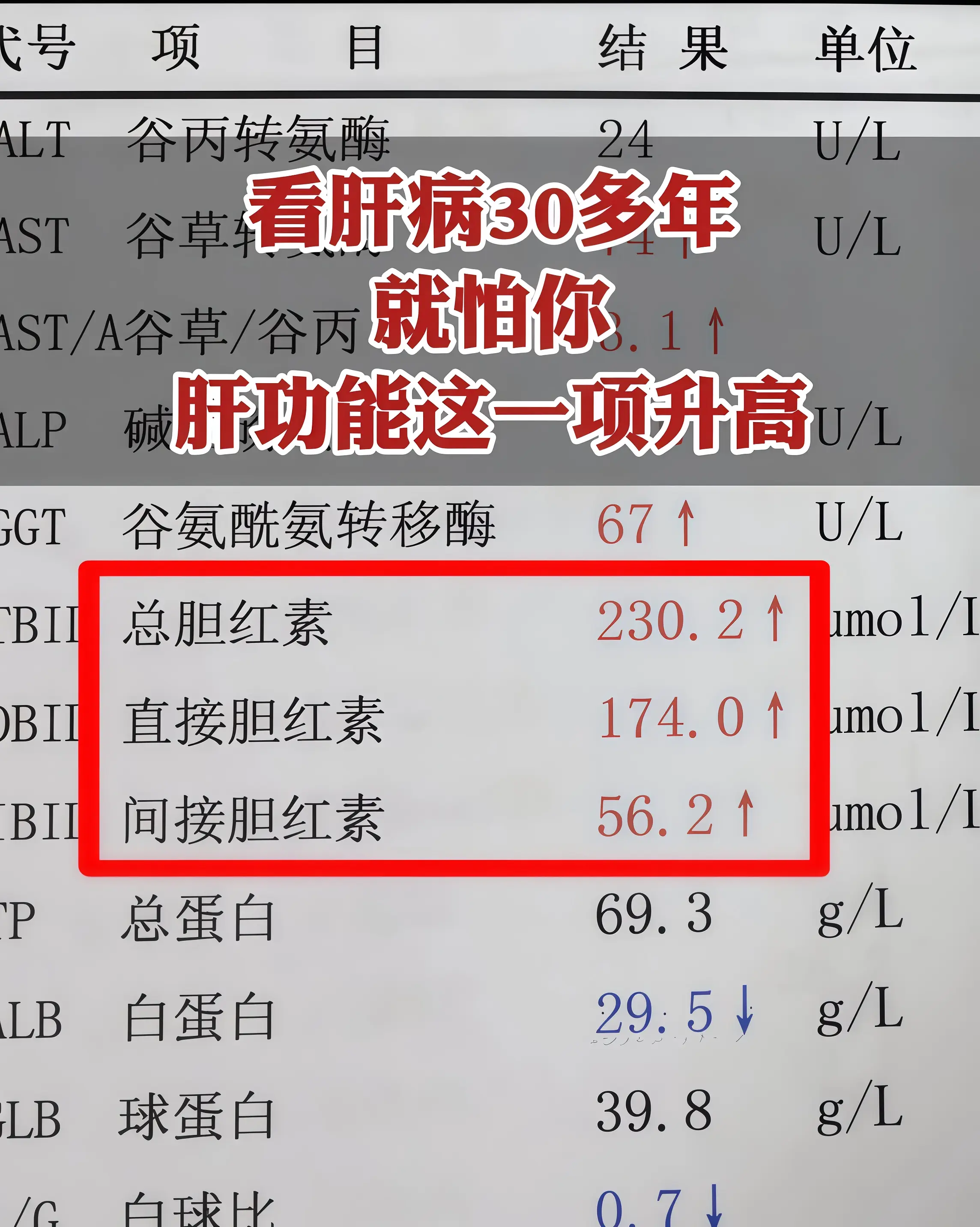 大家看这张化验单，当时一看见上面的指标我心一沉，转氨酶只是轻度升高，胆...