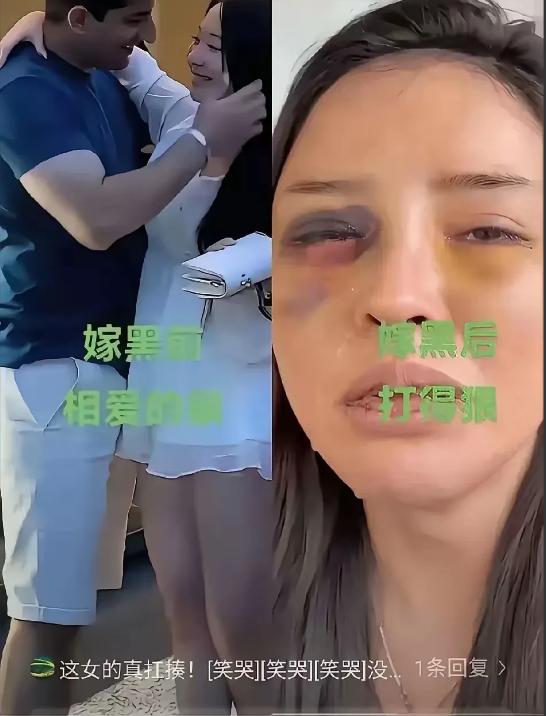 前如胶似漆，婚后鼻青脸肿！这种照片给人的警示触目惊心，没有对比就不知道伤害。