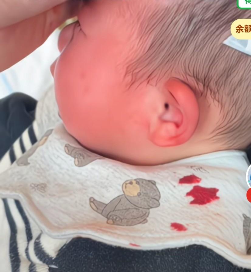 六个月宝宝让亲爷爷后奶奶带了12天，发烧生病一直拖，导致孩子进ICU，孩子