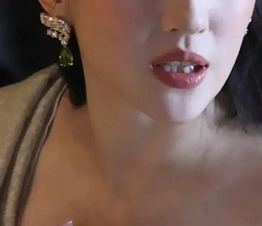 有钱人牙不齐也不弄整，是为了追求纯天然的感觉吗？