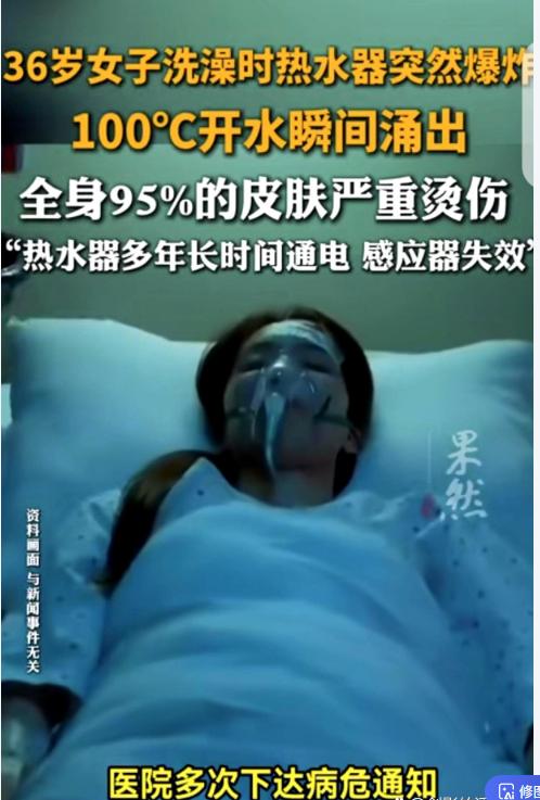 陕西西安36岁女子洗澡时热水器突然爆炸，100℃开水从头浇下，全身95%皮肤烫伤