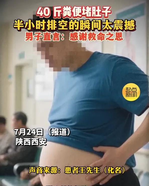 男子体内藏40斤粪便体型像青蛙】7月24日（报道），陕西西安。40斤粪便堵在