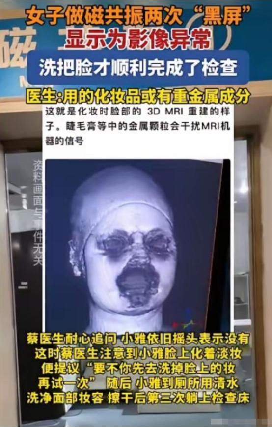 解释不清了！福建一29岁女生头晕，去医院做头颅磁共振，不料，连续2次扫描，都因面