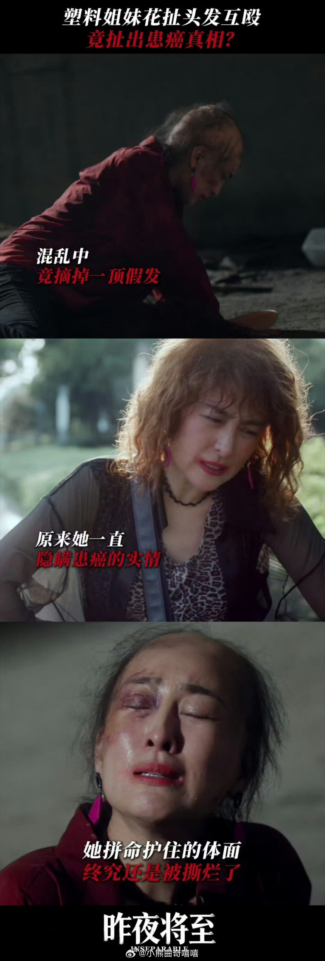 没认出这是马苏昨夜将至差点没认出马苏马苏在新剧里大胆尝试光头形象，素颜出镜，扮相