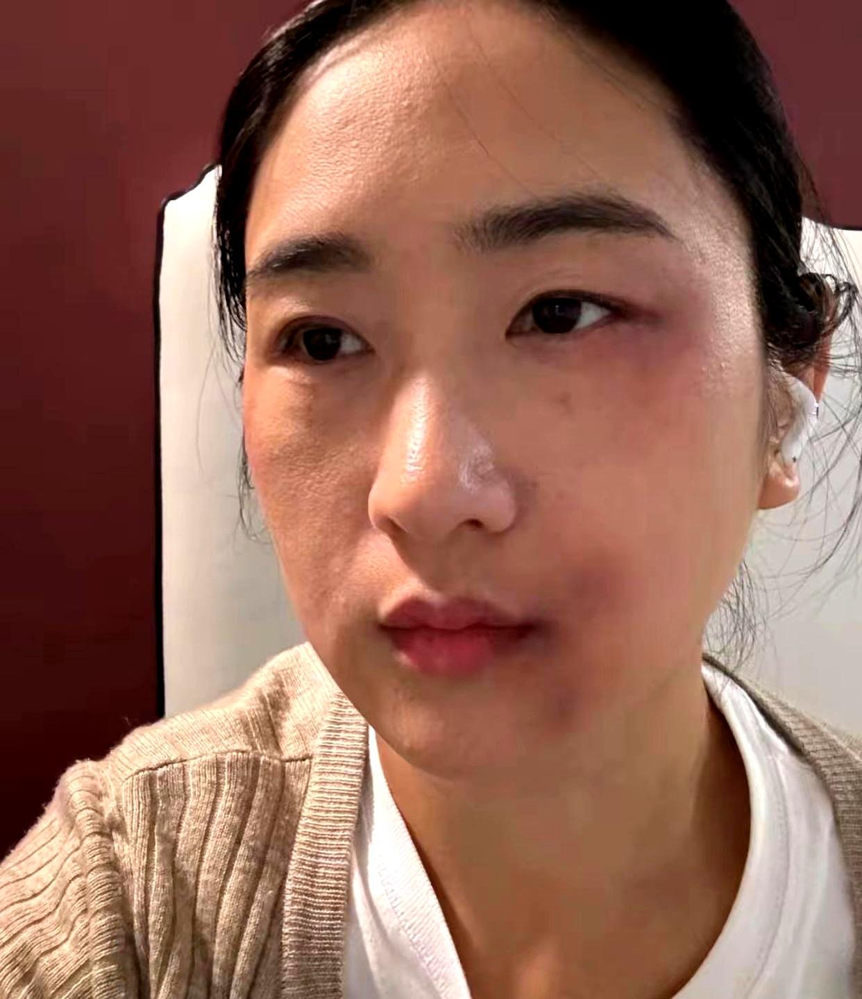 灯还亮着时，巴掌已经落下，三个月的孕期，屋里只剩屏幕的白光。丈夫替亲妈“出气”
