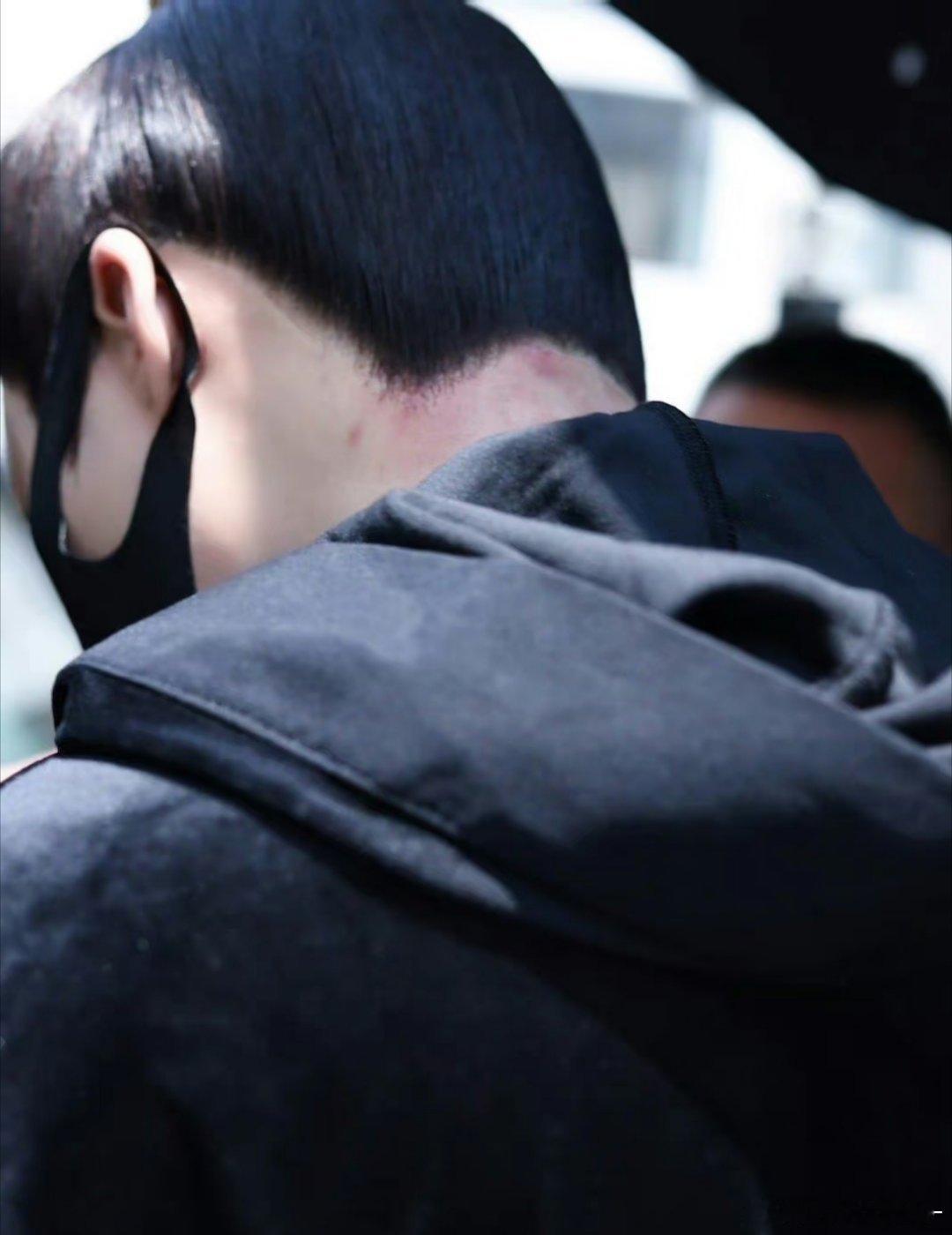 刘宇宁脖子这个是过敏吗？一直在反复🥺