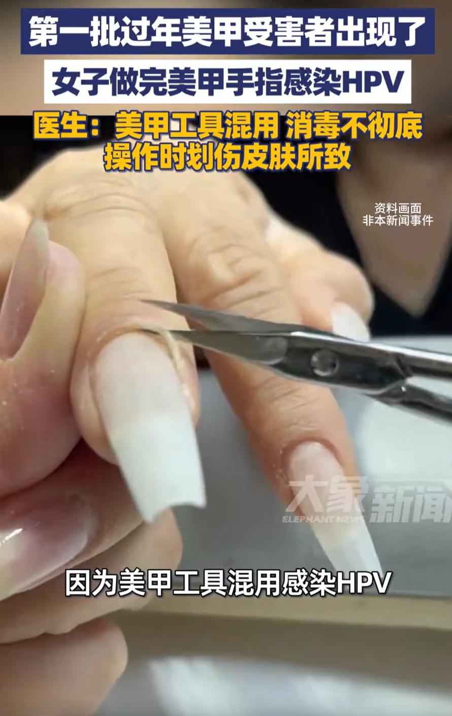 让人担心的事情还是出现了！湖北武汉，一女子年前去做美甲，结果做完没几天，就发现指