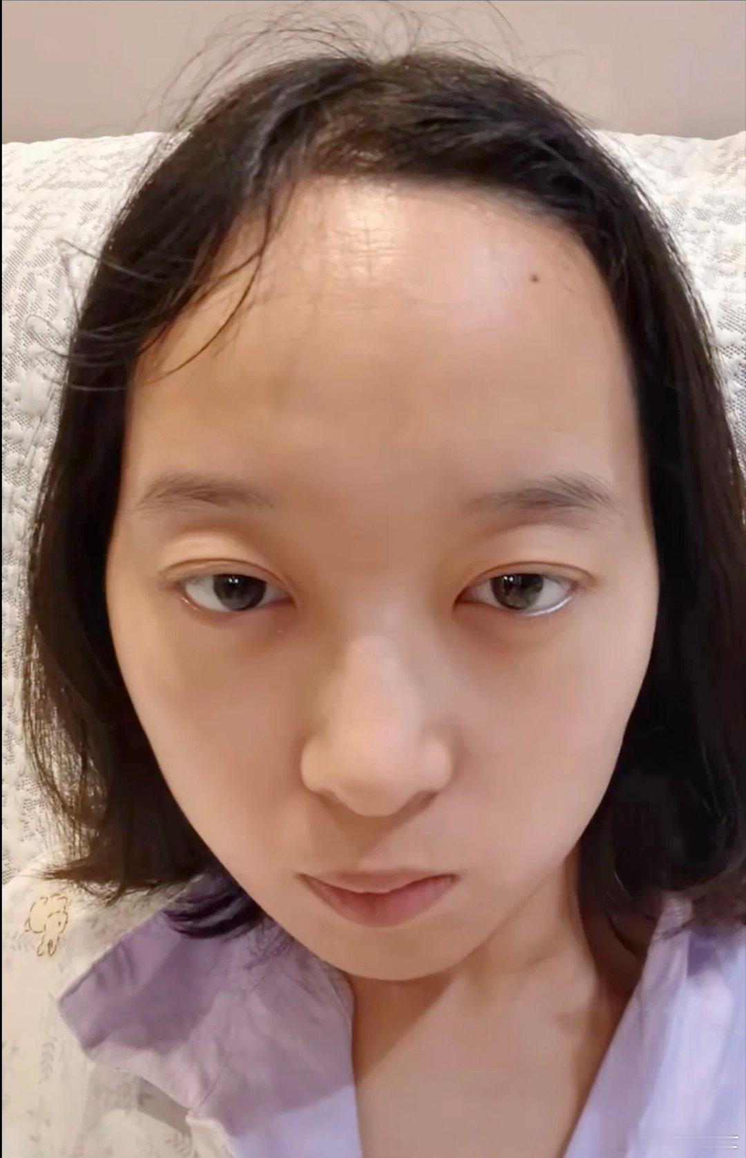 女人面相罕见“天包地”是凶相吗？最典型的特征是额头高度远超常规四指半的标准，搭配