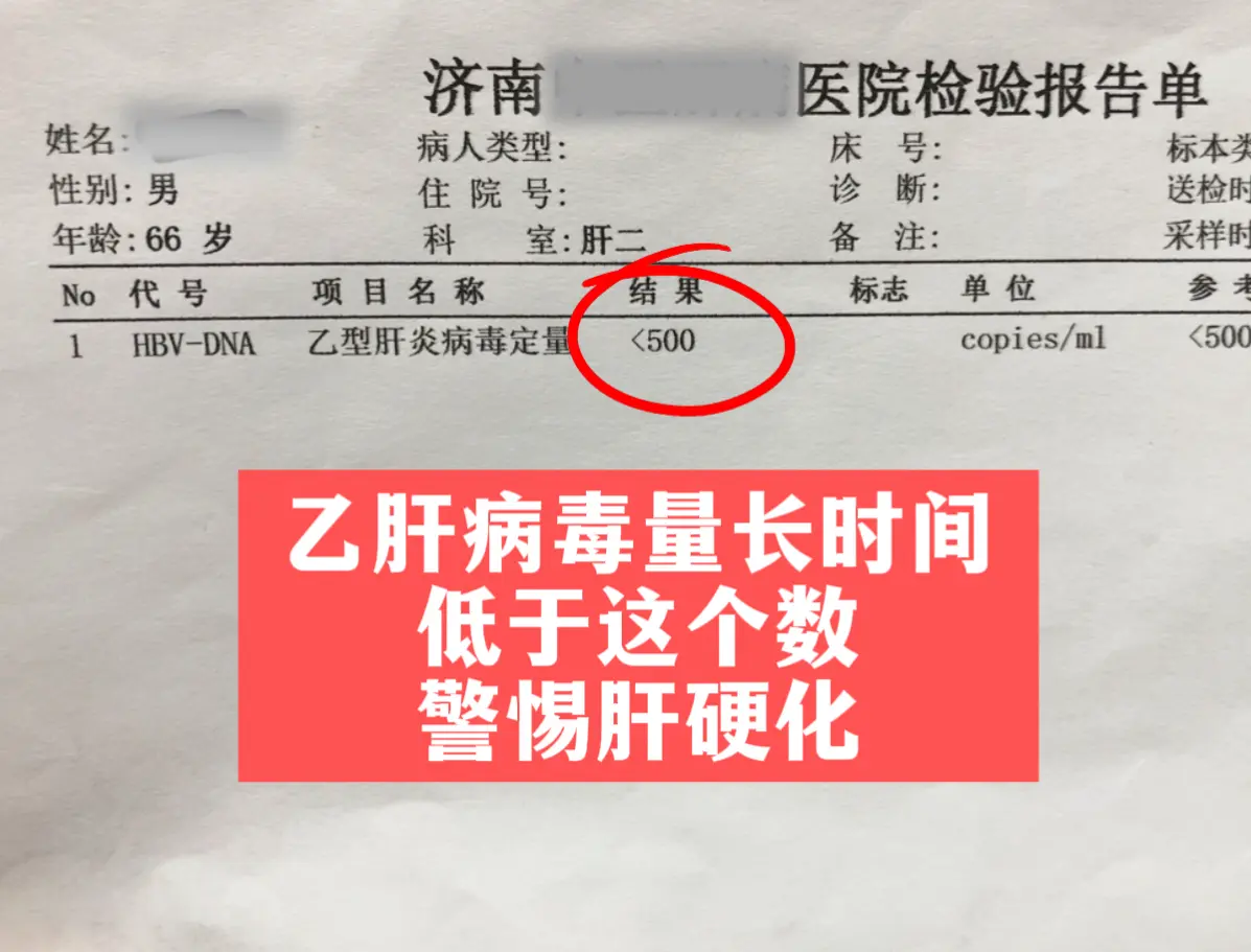 春节刚接诊，就遇见一位济南本地的患者，跟我哭着说后悔。乙肝病史十多年...