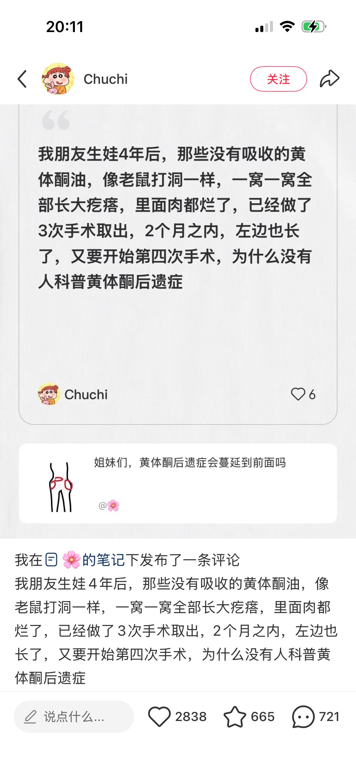 震惊