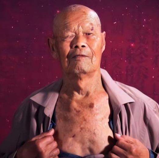 1956年，35岁农民，咳嗽10年，拒绝就医，一天，他突然用力咳嗽，“哇”的一声