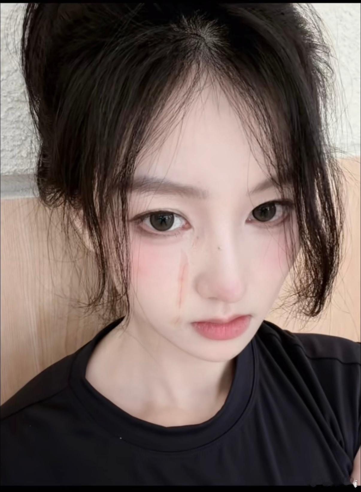 炫迈妹子自曝被猫误伤过两次炫迈妹子回应被猫误伤炫迈妹子发文：我被小猫误伤了，很