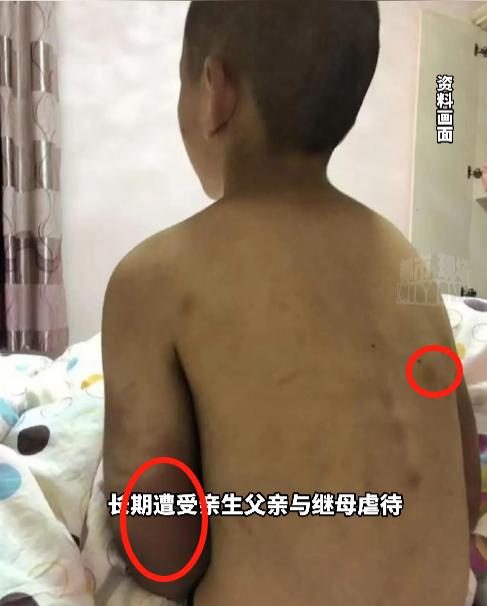 🌙“这生父禽兽不如！”河南一女子接到哥哥电话，说她14岁的侄子没了，突如其来的