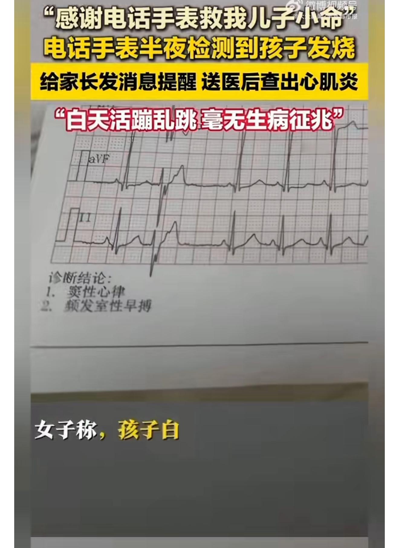 电话手表半夜发信息救下发烧娃别寻思手表没有用啊！平常你觉得没事的时候，它都能感知