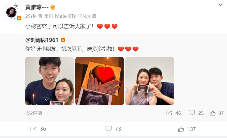 黄雅琼怀孕✌️恭喜雅琼！以前见到郑思维的艾登就很喜的雅琼，终于要迎来自己的宝宝