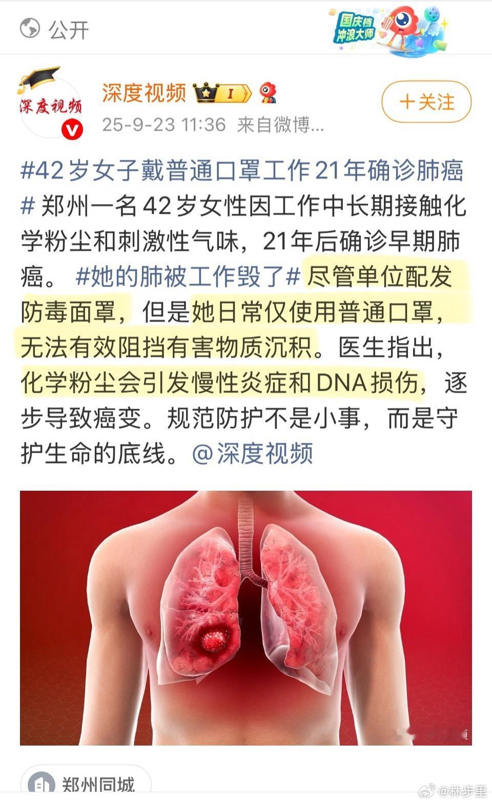 42岁女子戴普通口罩工作21年确诊肺癌这是哪个媒体小编弄的词条。点进去，详情写的