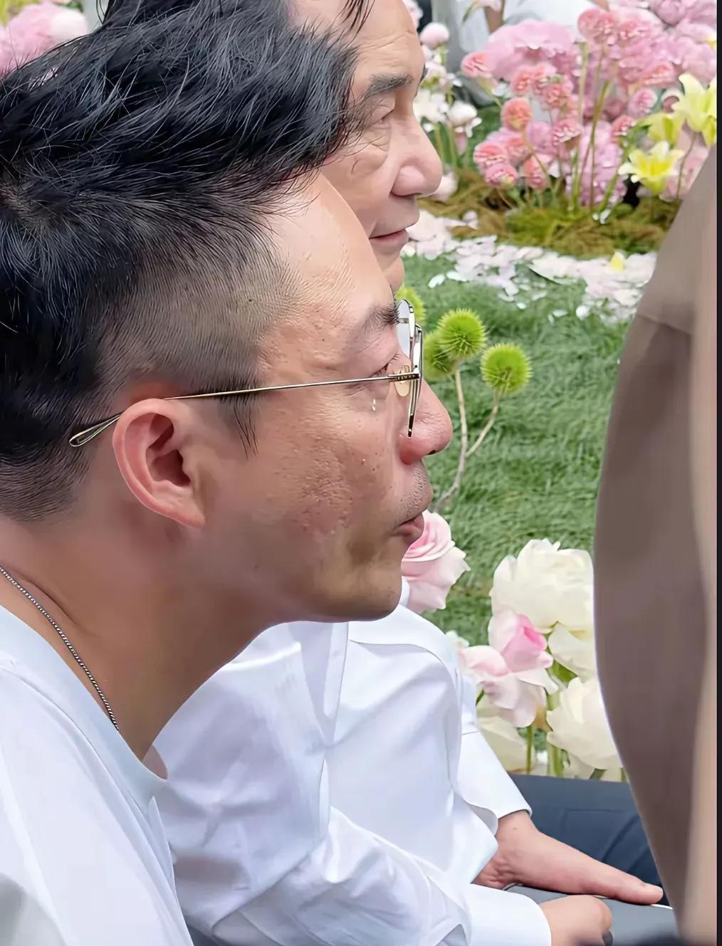 真实的汪小菲，让女粉丝们尖叫了！终于看到了汪小菲的真实容颜，脸上坑坑洼洼的，满