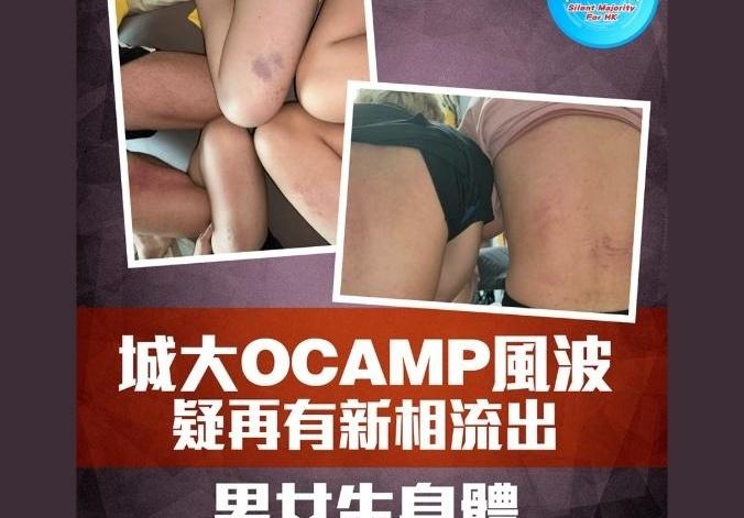 上大学是去学本事的，还是去“渡劫”的？后背打得通红、大腿全是瘀青，不知道的还以为