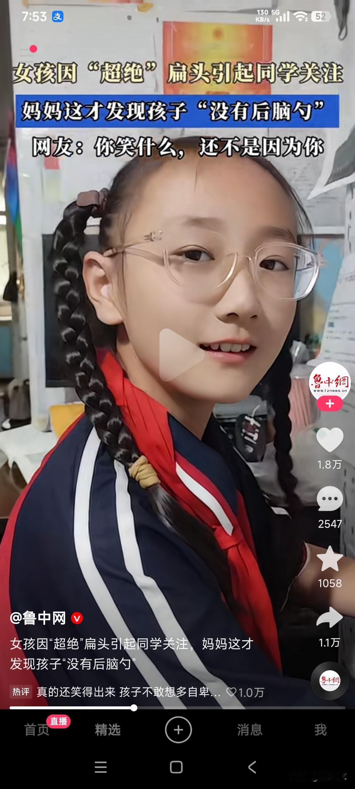 女孩因超绝扁头引起同学的关注，妈妈突然之间才发现孩子没有后脑勺，网友都说孩子没有