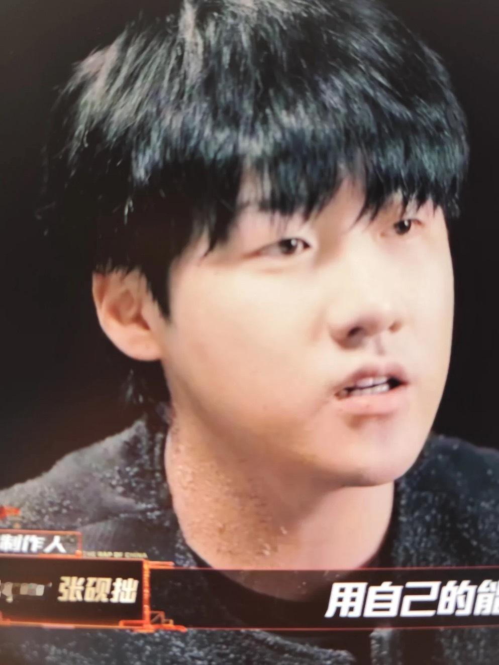 capper哥你脖子咋了？？？纯路人…好奇脖子怎么了​​​