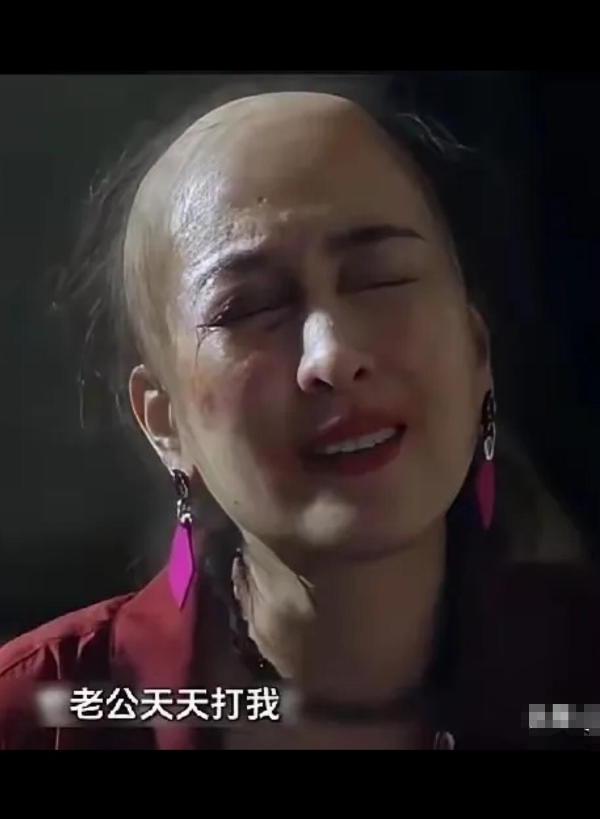 马苏，一夜间就上了热门？三料视后，如今在剧里剃成秃头，演一个被打到绝望的乳腺