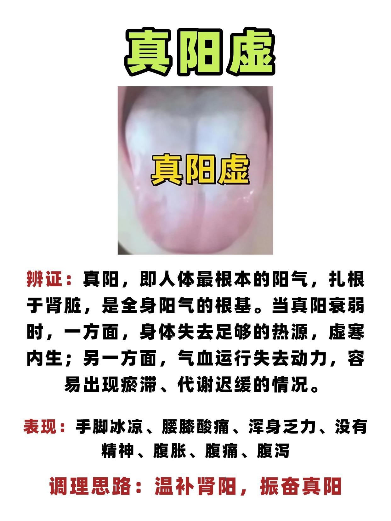 为什么有的手脚发热还怕冷，有的人手脚冰凉却怕热？教你一招，分清真假阳虚！