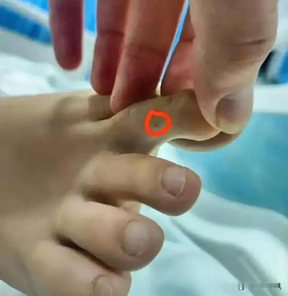 女孩海南旅游被蛇咬身亡固然可惜，但也不该过于苛责海南医生！根据卫健委的通报，患