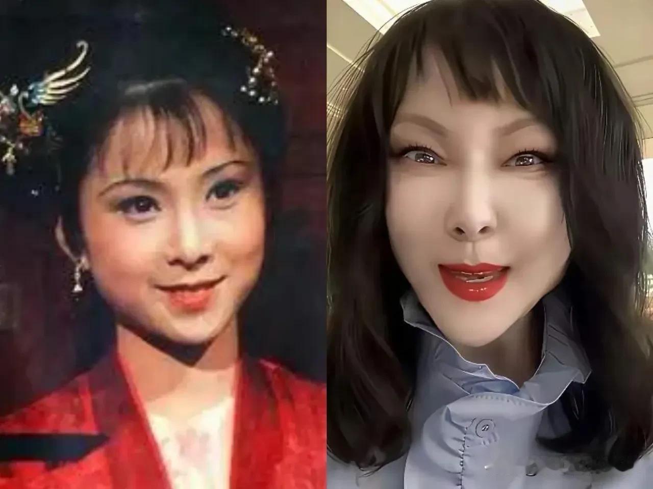 这居然是87版红楼梦的晴雯扮演者？她这张脸已经被医美毁了，成了典型的蛇精脸，吊梢