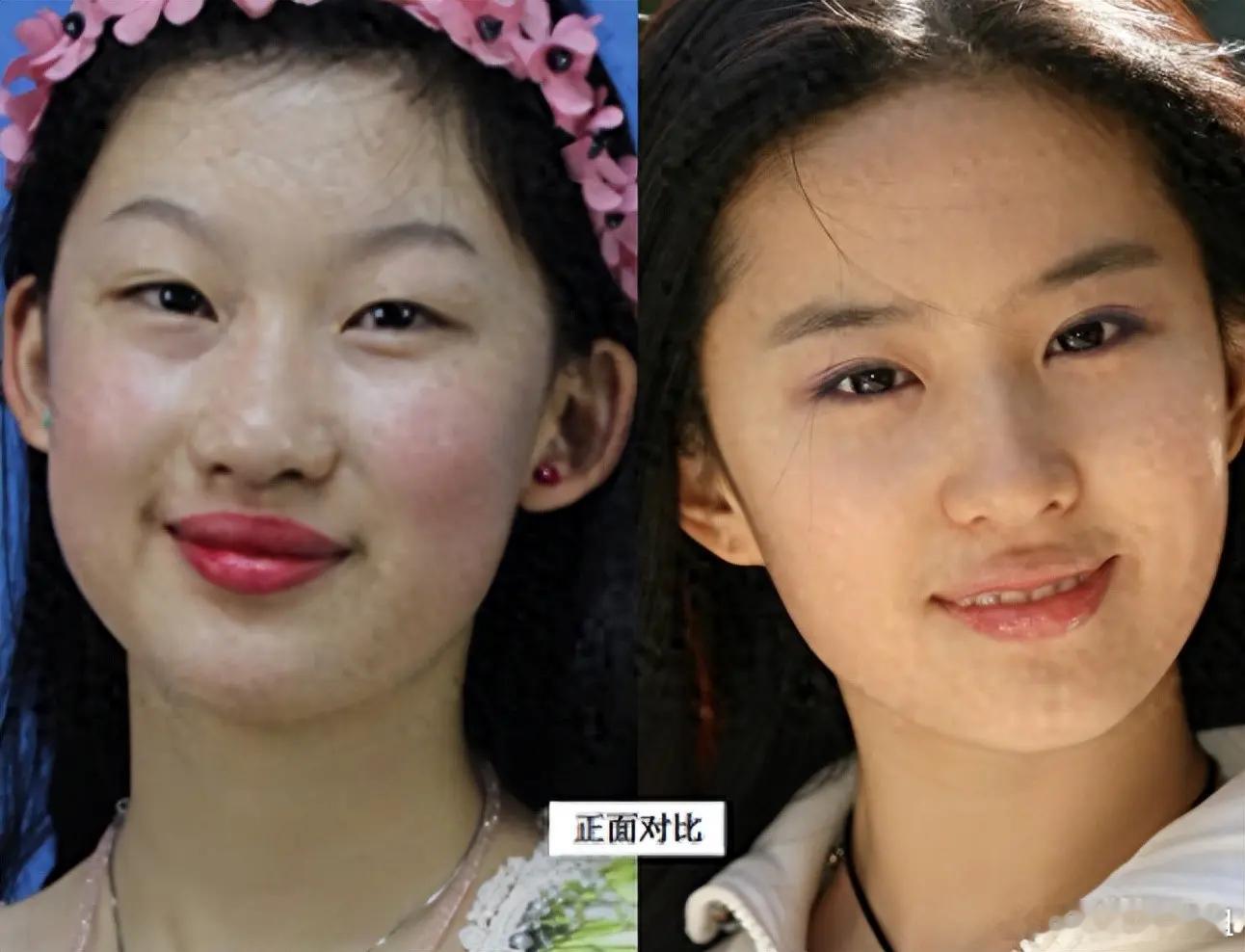 19岁少女削肉剔骨整成刘亦菲，9年后，她终归走上不同的路！​​​