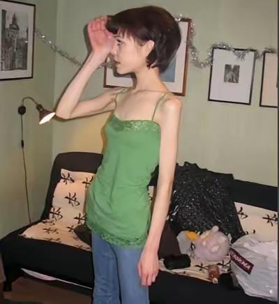 河南一90后女子为减肥辟谷，半个月不吃饭、只喝水，一个月瘦了40斤，代价是什么？