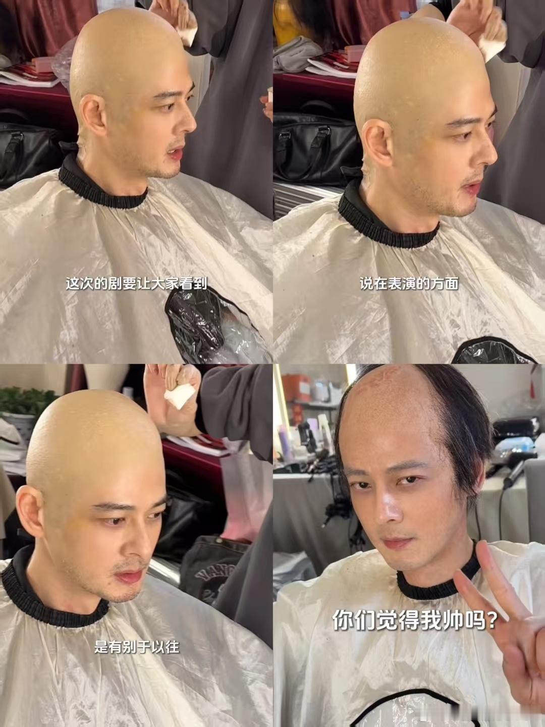 郭品超怎么说服自己演秃头的之前都觉得是一个大帅哥呀，没有想到这一次秃头的角色
