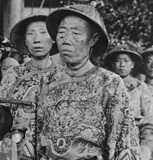 1966年，北京发现了太监李莲英的墓，当专家打开棺椁准备处理遗体时，竟被其下体的