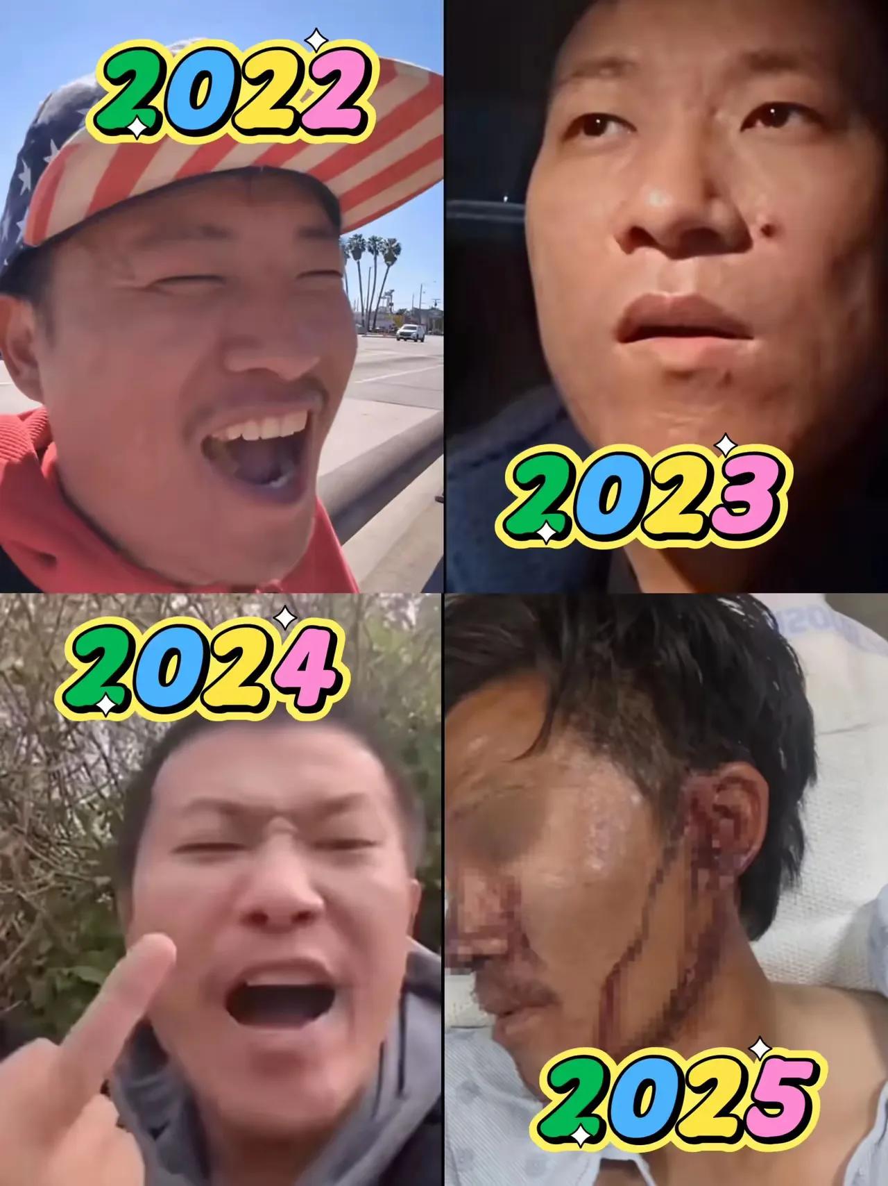 著名恨国党王伟恨又双叒叕被打了，而且很厉害，很严重。网友有才，搞了一组图片，
