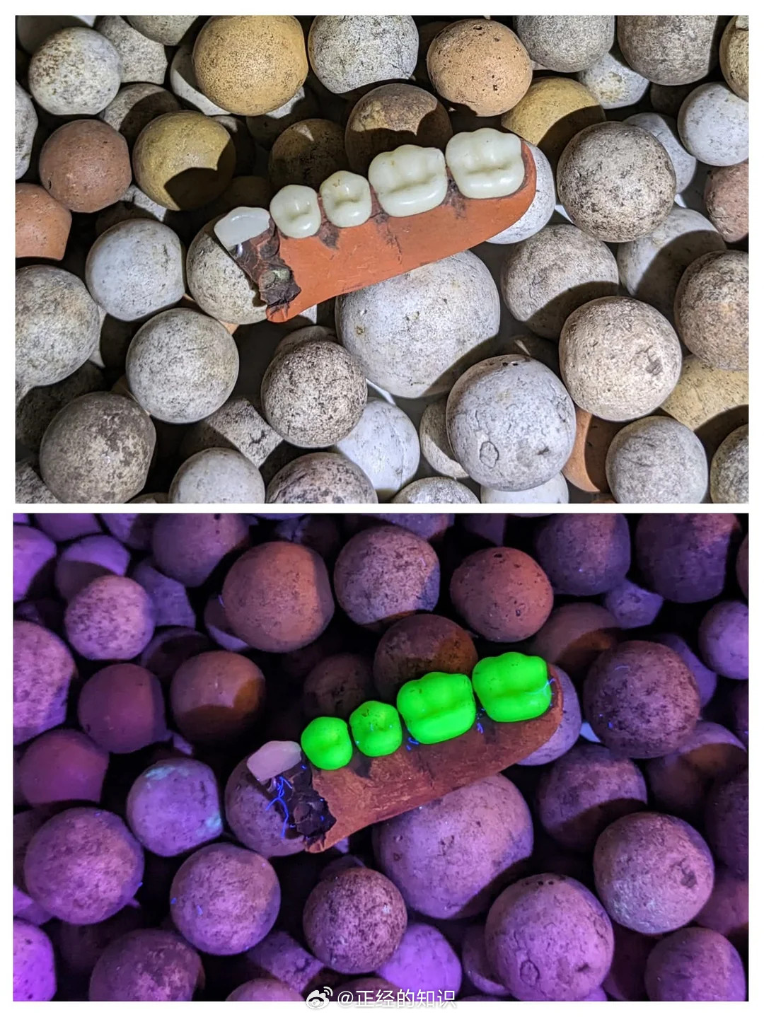 在英国维多利亚时代的垃圾填埋场找到了这些乳白铀玻璃假牙，是获得许可的铀玻璃假牙