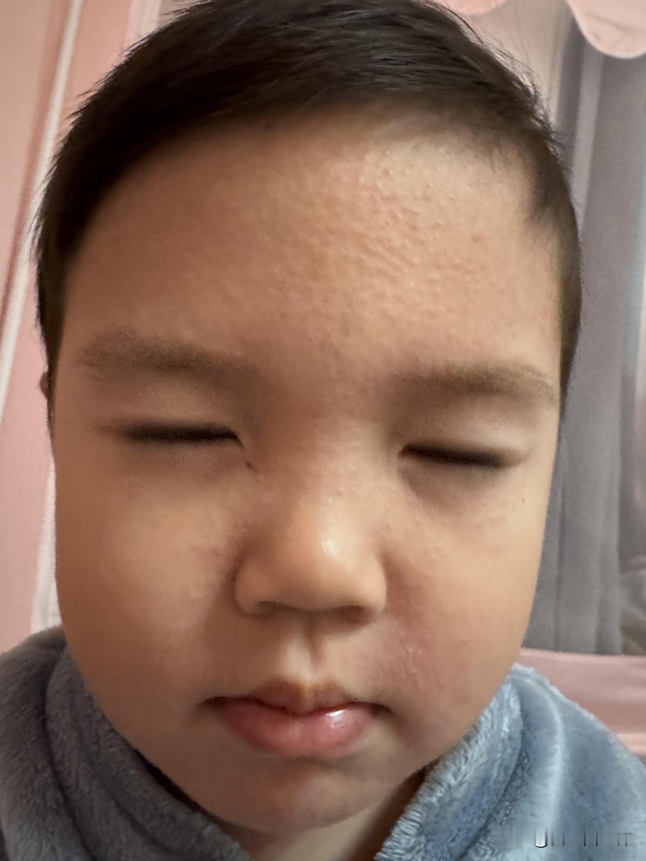 换面霜把宝宝脸弄伤了！真的悔到肠子青😭宝妈们真的别乱给娃换护肤品啊随手入的