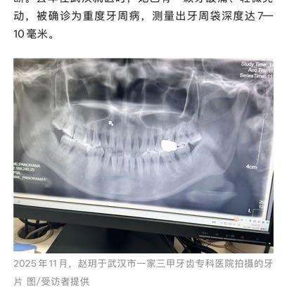 最近刷到一个31岁女生的新闻，真心让人挺揪心的。这位住在广州的小姐姐容堇，年纪轻