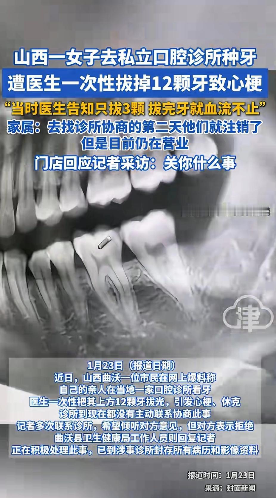 山西一女子去私立口腔诊所种牙，遭医生一次性拔掉12颗牙导致心梗。山西这事儿太离