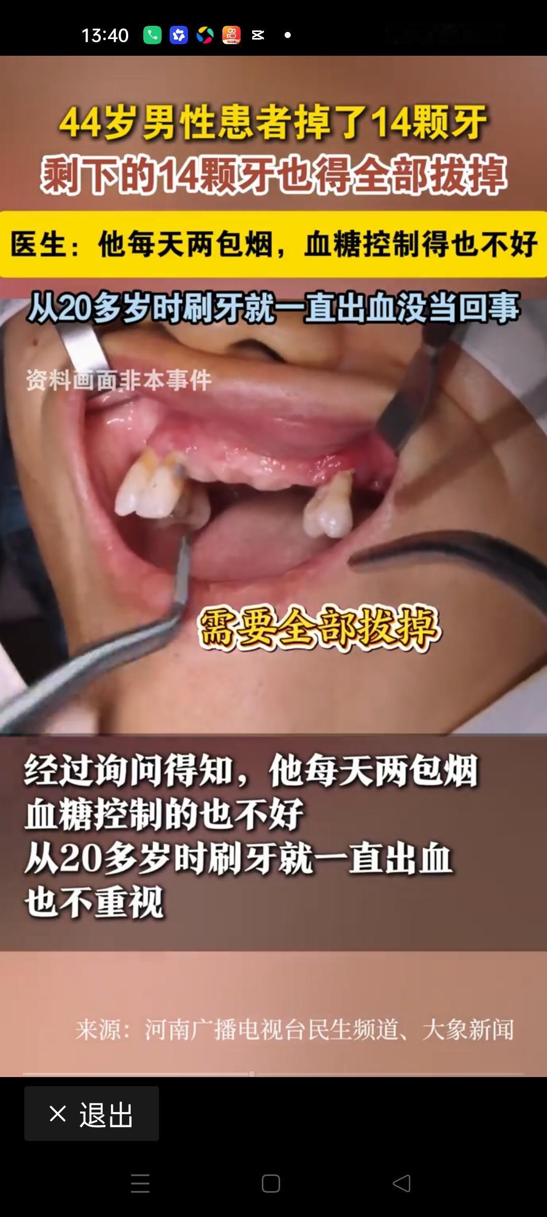 满口牙保不住，不是牙疼，是你在拿命换烟抽44岁，本该是身强体健、撑起家庭的