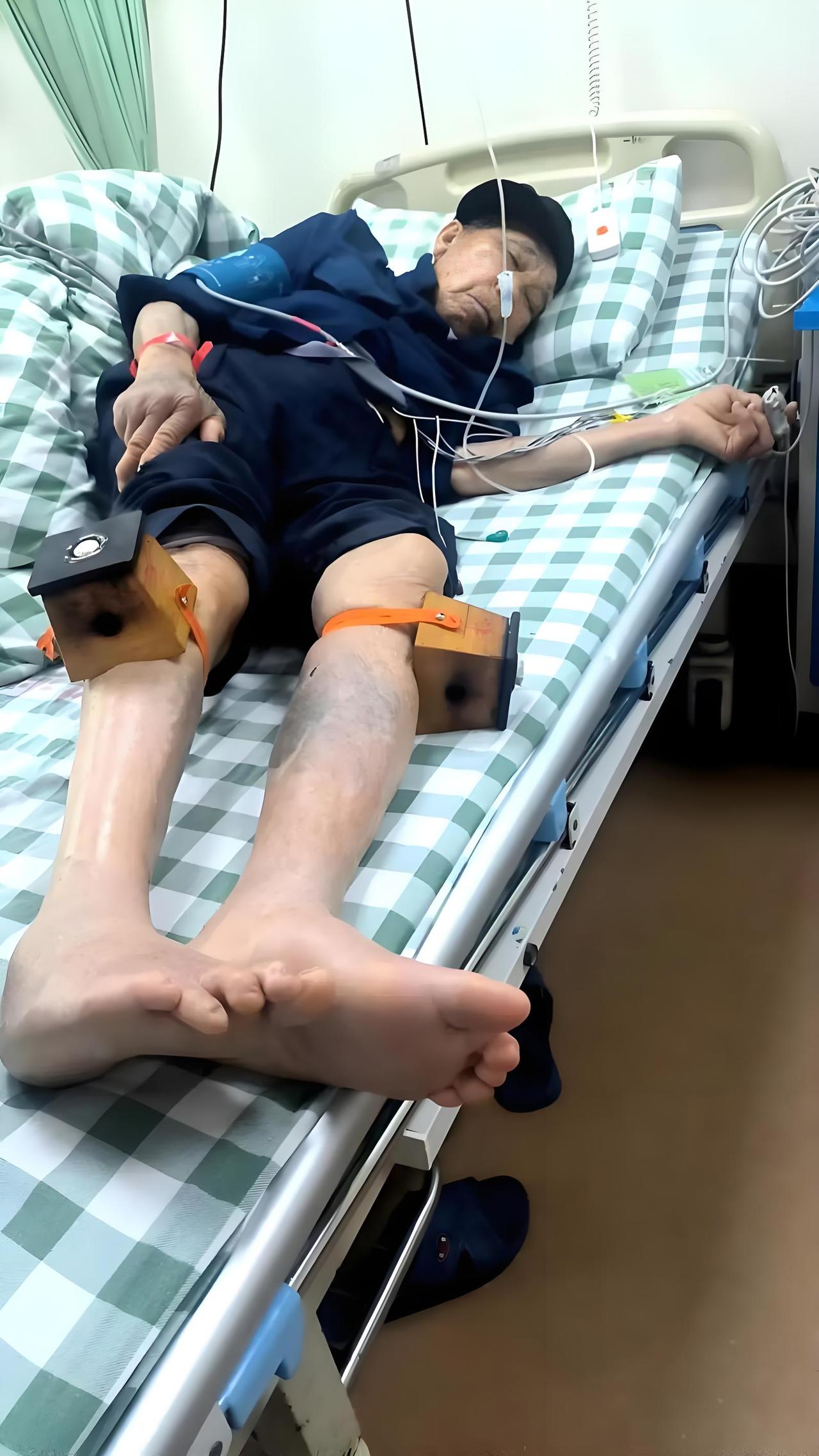 慢阻肺患者身体逐渐消瘦是常见现象，多由能量消耗增加、营养摄入不足、慢性炎症及合并