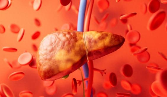 全球近一半肝癌在中国，再三提醒：家中的4种食物，尽早撤下餐桌中国作为全球肝癌