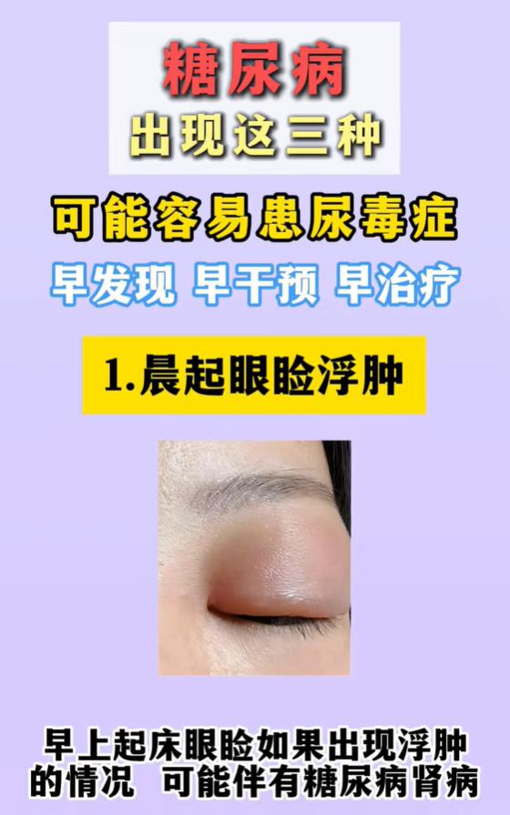 糖尿病人群留意：3个身体信号，警惕肾脏损伤风险